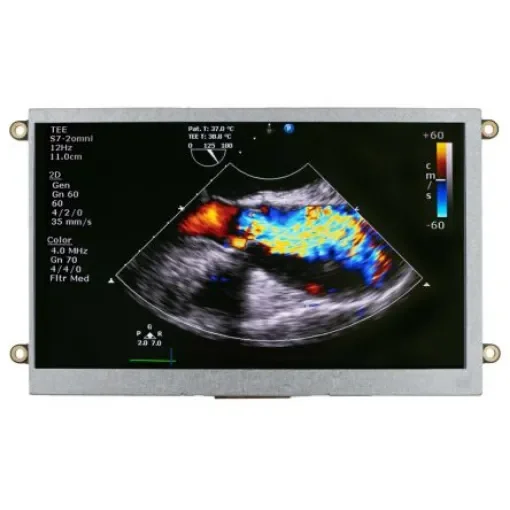 NEWHAVEN DISPLAY INTERNATIONAL NHD-7.0-HDMI-N-RSXP IPS TFT TFT LCD Display / Touch Screen, 7in, 800 x 480pixels product image